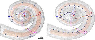 Polarity Sensitivity of Human Auditory Nerve Fibers Based on Pulse Shape, Cochlear Implant Stimulation Strategy and Array